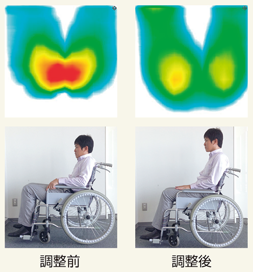 体圧分布図