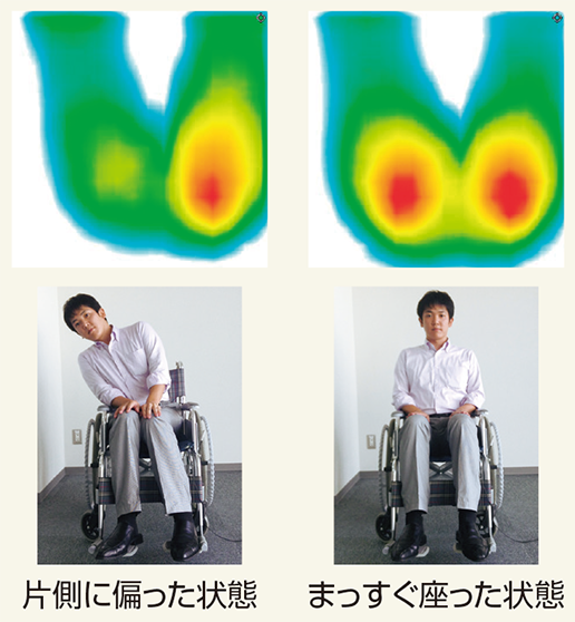 体圧分布図